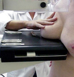 El diagnóstico precoz de cácer de mama implantado en la comunidad al cien por cien
